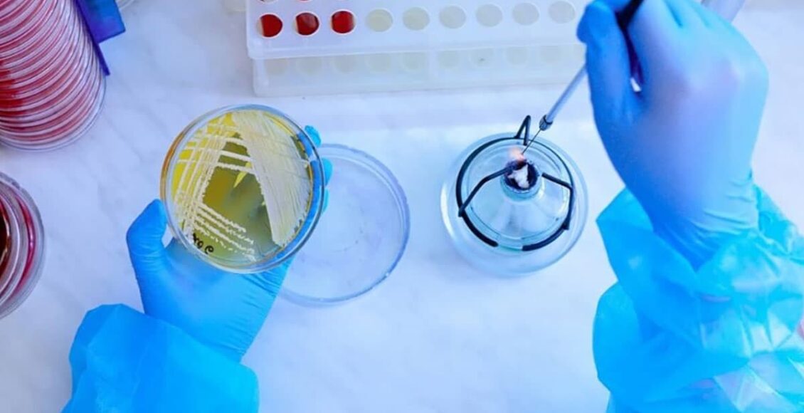 ثبات دما مخصوص ذخیره سازی و نگهداری باکتری ها